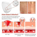 Derma Smooth Pimple Patch