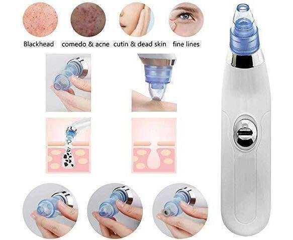 3 In 1 Black Head Remover Machine